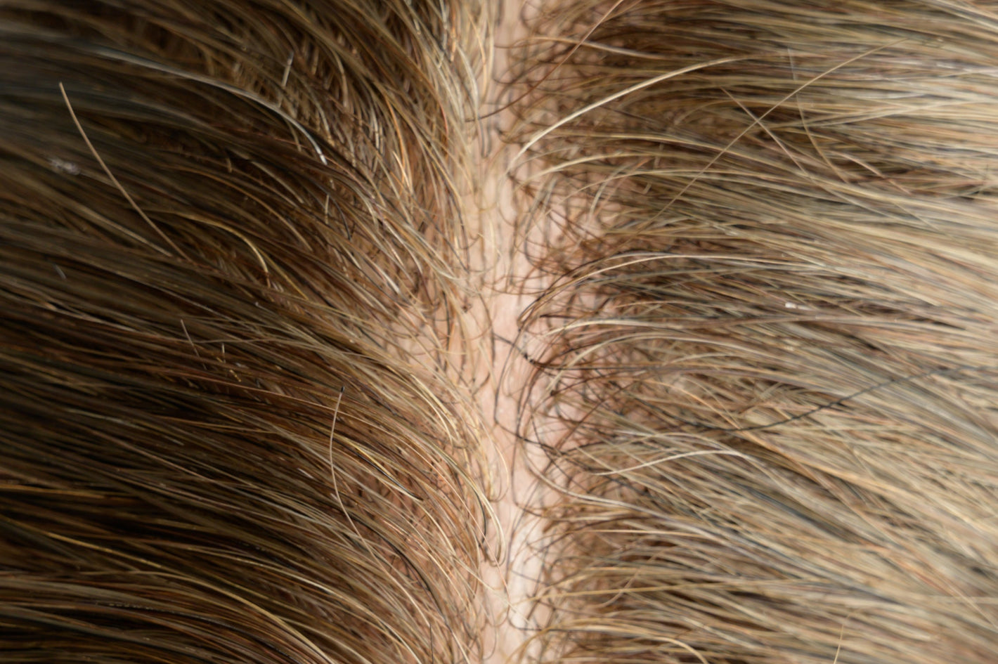 [Stock Unit] French Lace with Window-Shape Skin Base - Men's Toupee Hair System